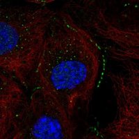 Anti-ACOT13 antibody produced in rabbit HPA019881-100UL