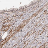 Anti-ADAMTS2 antibody produced in rabbit 