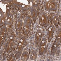 Anti-ADAMTS20 antibody produced in rabbit 