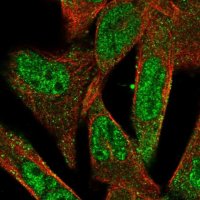 Anti-ADAMTS5 antibody produced in rabbit 