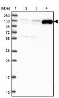 Anti-ADAMTS6 antibody produced in rabbit 