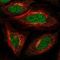 Anti-ADAT1 antibody produced in rabbit 