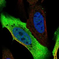Anti-ADH1A antibody produced in rabbit HPA047814-100UL