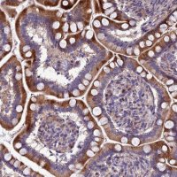Anti-ADIPOR2 antibody produced in rabbit 