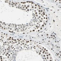 Anti-ADNP antibody produced in rabbit 