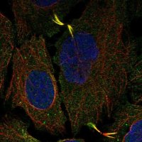 Anti-AGBL5 antibody produced in rabbit 