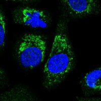 Anti-ALDH16A1 antibody produced in rabbit 