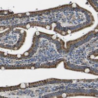 Anti-ALDH18A1 antibody produced in rabbit 