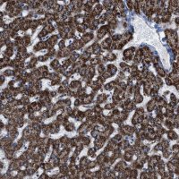 Anti-ALDH1B1 antibody produced in rabbit 