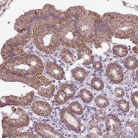 Anti-ALDH2 antibody produced in rabbit HPA051065-100UL