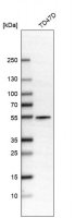 Anti-ALDH9A1 antibody produced in rabbit 