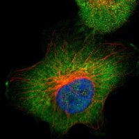 Anti-ALDOA antibody produced in rabbit 