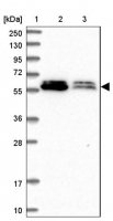 Anti-ALG10 antibody produced in rabbit HPA043329-100UL