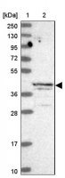 Anti-ALKBH1 antibody produced in rabbit 