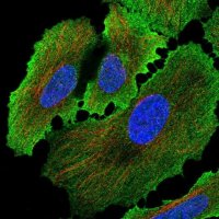 Anti-ALPP antibody produced in rabbit 