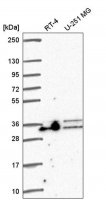 Anti-ALYREF antibody produced in rabbit HPA061282-100UL