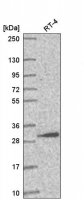 Anti-AMMECR1L antibody produced in rabbit HPA057234-100UL