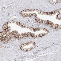 Anti-ANGEL2 antibody produced in rabbit 