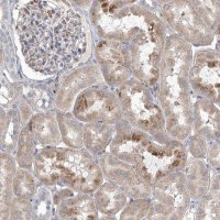 Anti-ANGPTL3 antibody produced in rabbit 