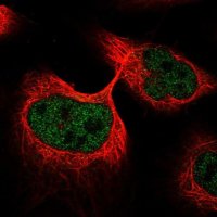 Anti-ANKDD1A antibody produced in rabbit 