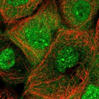 Anti-ANKMY1 antibody produced in rabbit 