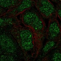Anti-ANKRD22 antibody produced in rabbit 