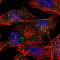 Anti-ANKRD26 antibody produced in rabbit 