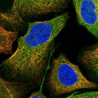 Anti-ANKRD34A antibody produced in rabbit 