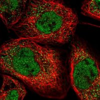 Anti-ANKRD39 antibody produced in rabbit 