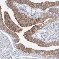 Anti-ANKS1A antibody produced in rabbit 