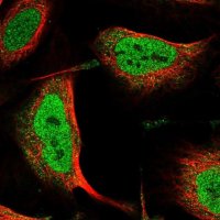 Anti-ANKS3 antibody produced in rabbit 