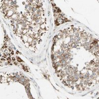 Anti-ANKS6 antibody produced in rabbit 