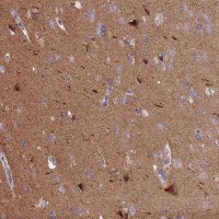 Anti-ANO3 antibody produced in rabbit 