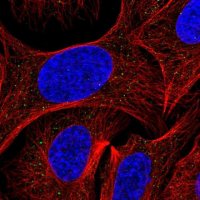 Anti-AP3S2 antibody produced in rabbit 