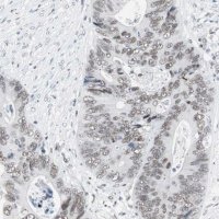 Anti-ARID1A antibody produced in rabbit 