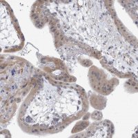 Anti-ARSI antibody produced in rabbit 