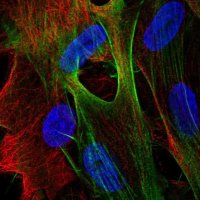 Anti-ARSJ antibody produced in rabbit HPA036481-100UL