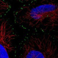 Anti-ASB16 antibody produced in rabbit 