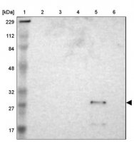 Anti-ASB6 antibody produced in rabbit 