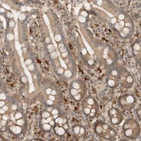 Anti-ASPSCR1 antibody produced in rabbit 