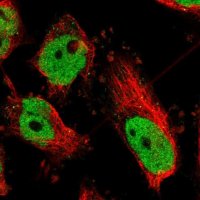 Anti-ATF2 antibody produced in rabbit 