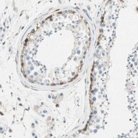 Anti-ATF6 antibody produced in rabbit 