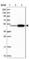 Anti-ATF7IP2 antibody produced in rabbit 