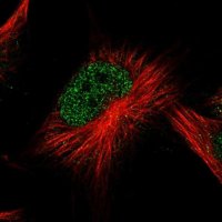 Anti-ATG2B antibody produced in rabbit 