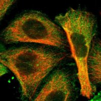 Anti-ATG7 antibody produced in rabbit 