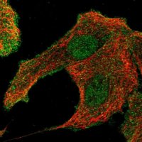 Anti-ATP10D antibody produced in rabbit 