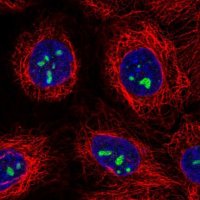 Anti-ATP13A3 antibody produced in rabbit 