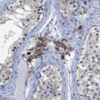 Anti-ATP7B antibody produced in rabbit 