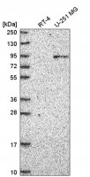 Anti-ATRIP antibody produced in rabbit 