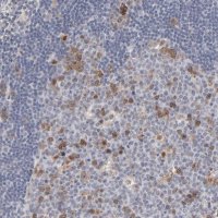 Anti-AURKA antibody produced in rabbit 